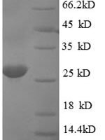Human Apoptosis regulatory protein Siva (SIVA1) Recombinant Protein, N-His-SUMO - BioCrest Sci
