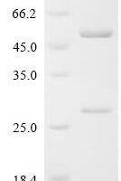 Human Importin subunit beta-1 (KPNB1) Recombinant Protein, C-10His - BioCrest Sci