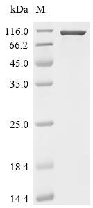 Human Complement factor B (CFB) Recombinant Protein, C-10His, Mammalian cell, C-terminal 10xHis-tagged, 85.7 kDa, purity >≥ 95% as determined by SDS-PAGE.