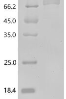 Mouse Desmoglein-3 (Dsg3),partial Recombinant Protein - BioCrest Sci