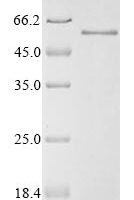 Human Mothers against decapentaplegic homolog 3 (SMAD3) Recombinant Protein, N-10His, aa 1–425, Baculovirus - BioCrest Sci