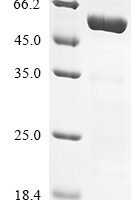 Human Transcription factor Jun (JUN) Recombinant Protein, N-His-SUMO - BioCrest Sci