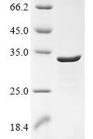 Human Piezo-type mechanosensitive ion channel component 2 (PIEZO2), partial Recombinant Protein - BioCrest Sci