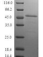 Human Proteasome subunit beta type-10 (PSMB10) Recombinant Protein - BioCrest Sci