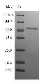 Human Proteasome subunit beta type-10 (PSMB10) Recombinant Protein, Homo sapiens (Human), E.coli, N-terminal GST-tagged, 51.6 kDa, purity >≥ 90% as determined by SDS-PAGE.