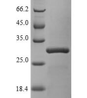 Human Chromobox protein homolog 7 (CBX7) Recombinant Protein, N-His, aa 1–251, E.coli - BioCrest Sci