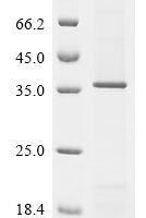 Rat Zinc transporter ZIP6 (Slc39a6), partial Recombinant Protein, C-10His - BioCrest Sci