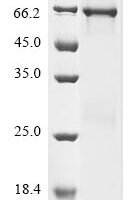 Human Flt3-interacting zinc finger protein 1 (FIZ1) Recombinant Protein - BioCrest Sci