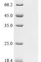 Human Importin subunit alpha-1 (KPNA2) Recombinant Protein - BioCrest Sci