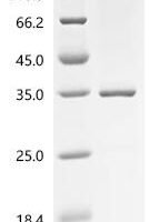 Human Retinoblastoma-associated protein (RB1), partial Recombinant Protein, C-His, aa 729–928 - BioCrest Sci