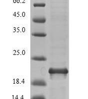 Vibrio vulnificus Fe/S biogenesis protein NfuA (nfuA) Recombinant Protein, Tag-Free - BioCrest Sci