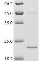 Human Kita-kyushu lung cancer antigen 1 (CT83) Recombinant Protein, C-His - BioCrest Sci