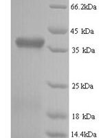 Bovine Retinol-binding protein 3 (RBP3), partial Recombinant Protein, N-His - BioCrest Sci
