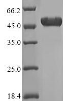 Human ATP synthase F(1) complex subunit beta, mitochondrial (ATP5F1B), partial Recombinant Protein - BioCrest Sci