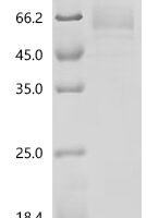 Human Endogenous retrovirus group K member 6 Env polyprotein (ERVK-6), partial Recombinant Protein, C-10His - BioCrest Sci