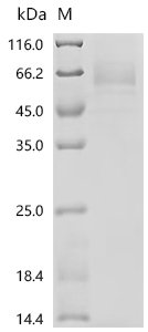 Human Endogenous retrovirus group K member 6 Env polyprotein (ERVK-6), partial Recombinant Protein, C-10His, Homo sapiens (Human), Mammalian cell, C-terminal 10xHis-tagged, 44.1 kDa, purity >≥ 85% as determined by SDS-PAGE.