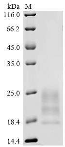 Cowpox virus 14 kDa protein (A27L) Recombinant Protein, Cowpox virus (CPV), Mammalian cell, C-terminal 10xHis-tagged, 14.4 kDa, purity >≥ 95% as determined by SDS-PAGE.