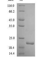 Human Integrin alpha-2 (ITGA2), partial Recombinant Protein - BioCrest Sci