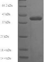 Human Deoxynucleotidyltransferase terminal-interacting protein 1 (DNTTIP1) Recombinant Protein - BioCrest Sci
