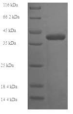 Human Deoxynucleotidyltransferase terminal-interacting protein 1 (DNTTIP1) Recombinant Protein, Homo sapiens (Human), E.coli, N-terminal 6xHis-tagged, 41.0 kDa, purity >≥ 90% as determined by SDS-PAGE.