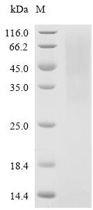 Porcine epidemic diarrhea virus Spike glycoprotein (S), partial Recombinant Protein, C-His, aa 19–278, Yeast, Porcine epidemic diarrhea virus (strain CV777) (PEDV), Yeast, C-terminal 6xHis-tagged, 30.2 kDa, purity >≥ 85% as determined by SDS-PAGE.