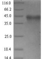 Rickettsia conorii Putative N-acetylmuramoyl-L-alanine amidase RC0497 (RC0497) Recombinant Protein - BioCrest Sci