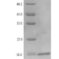Epstein-Barr virus Latent membrane protein 2 (LMP2), partial Recombinant Protein - BioCrest Sci