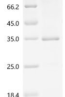 Dog Serine protease 1 (PRSS1) Recombinant Protein, C-10His - BioCrest Sci