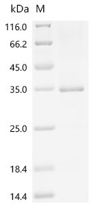 Dog Serine protease 1 (PRSS1) Recombinant Protein, C-10His, Canis lupus familiaris (Dog) (Canis familiaris), E.coli, C-terminal 10xHis-tagged, 33.4 kDa, purity >≥ 85% as determined by SDS-PAGE.