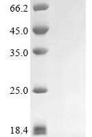 Human Lymphocyte antigen 6K (LY6K) Recombinant Protein, C-His - BioCrest Sci