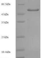 Human Tyrosine-protein phosphatase non-receptor type substrate 1 (SIRPA), partial Recombinant Protein, N-His-SUMO - BioCrest Sci