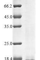 Human Cell surface hyaluronidase CEMIP2 (CEMIP2), partial Recombinant Protein - BioCrest Sci