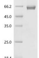 Human Serpin B5 (SERPINB5) Recombinant Protein, N-His-SUMOstar - BioCrest Sci