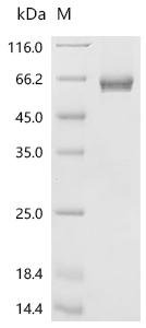 Human Serpin B5 (SERPINB5) Recombinant Protein, N-His-SUMOstar, Homo sapiens (Human), Yeast, N-terminal 6xHis-sumostar-tagged, 55.2 kDa, purity >≥ 95% as determined by SDS-PAGE.