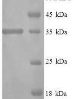 Human Interferon alpha-1/13 (IFNA1) Recombinant Protein, N-His-SUMO - BioCrest Sci