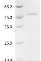 Human Platelet-derived growth factor D (PDGFD), partial Recombinant Protein, C-hFc1 - BioCrest Sci