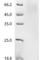 Pig Parathyroid hormone/parathyroid hormone-related peptide receptor (PTH1R), partial Recombinant Protein, C-His, aa 27–184, Mammalian cell - BioCrest Sci