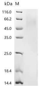 Pig Parathyroid hormone/parathyroid hormone-related peptide receptor (PTH1R), partial Recombinant Protein, C-His, aa 27–184, Mammalian cell, Sus scrofa (Pig), Mammalian cell, C-terminal 6xHis-tagged, 43.5 kDa, purity >≥ 85% as determined by SDS-PAGE.
