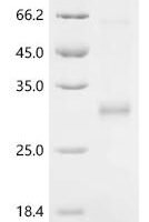 Human Cysteine and glycine-rich protein 2 (CSRP2) Recombinant Protein, N-His, Full-Length - BioCrest Sci