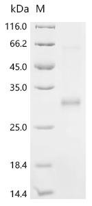 Human Cysteine and glycine-rich protein 2 (CSRP2) Recombinant Protein, N-His, Full-Length, Homo sapiens (Human), E.coli, N-terminal 6xHis-tagged, 27.9 kDa, purity >≥ 85% as determined by SDS-PAGE.