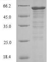 Human Receptor-interacting serine/threonine-protein kinase 3 (RIPK3) Recombinant Protein, N-10His/C-Myc - BioCrest Sci