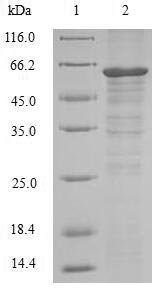 Human Receptor-interacting serine/threonine-protein kinase 3 (RIPK3) Recombinant Protein, N-10His/C-Myc, Homo sapiens (Human), Baculovirus, N-terminal 10xHis-tagged and C-terminal Myc-tagged, 60.9 kDa, purity >≥ 90% as determined by SDS-PAGE.