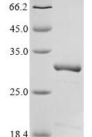 Escherichia coli O9:H4 5-methylthioadenosine/S-adenosylhomocysteine nucleosidase (mtnN) Recombinant Protein - BioCrest Sci