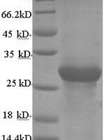 Bovine Adiponectin (ADIPOQ) Recombinant Protein, N-His-SUMO - BioCrest Sci