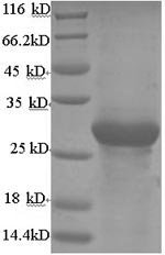 Bovine Adiponectin (ADIPOQ) Recombinant Protein, N-His-SUMO, Bos taurus (Bovine), E.coli, N-terminal 6xHis-SUMO-tagged, 40.4 kDa, purity >≥ 90% as determined by SDS-PAGE.