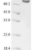 Klebsiella pneumoniae subsp. pneumoniae Penicillin-binding protein 1B, partial Recombinant Protein, C-His - BioCrest Sci