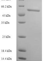 Human Thioredoxin reductase 1, cytoplasmic (TXNRD1), partial Recombinant Protein - BioCrest Sci