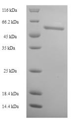 Human Thioredoxin reductase 1, cytoplasmic (TXNRD1), partial Recombinant Protein, Homo sapiens (Human), E.coli, N-terminal 6xHis-tagged, 70.5 kDa, purity >≥ 90% as determined by SDS-PAGE.
