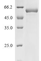 Mouse Tripartite motif-containing protein 72 (Trim72) Recombinant Protein, N-10His - BioCrest Sci