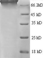 Human Glutamate carboxypeptidase 2 (FOLH1), partial Recombinant Protein - BioCrest Sci